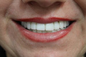 America's Family Dental America's Family Dental