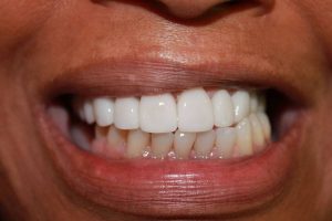 America's Family Dental America's Family Dental