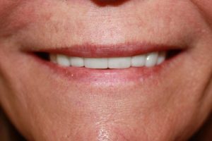 America's Family Dental America's Family Dental