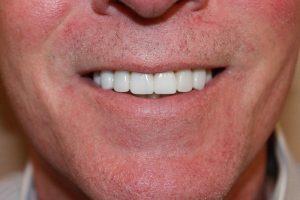 America's Family Dental America's Family Dental