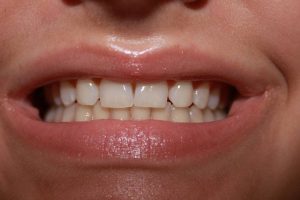 America's Family Dental America's Family Dental