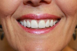 America's Family Dental America's Family Dental