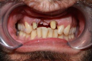 America's Family Dental America's Family Dental