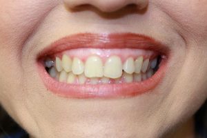America's Family Dental America's Family Dental