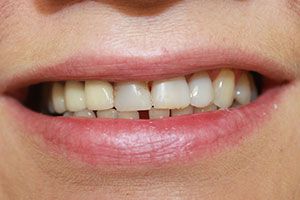 America's Family Dental America's Family Dental