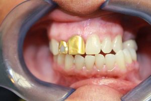 America's Family Dental America's Family Dental
