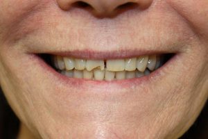 America's Family Dental America's Family Dental