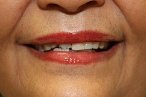 America's Family Dental America's Family Dental