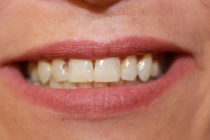 America's Family Dental America's Family Dental