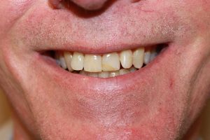 America's Family Dental America's Family Dental