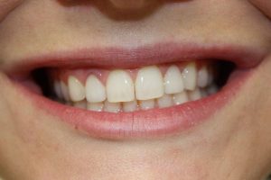 America's Family Dental America's Family Dental