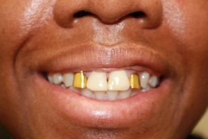 America's Family Dental America's Family Dental