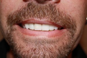 America's Family Dental America's Family Dental