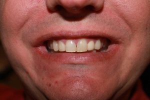 America's Family Dental America's Family Dental
