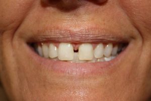 America's Family Dental America's Family Dental