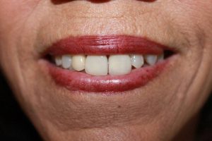 America's Family Dental America's Family Dental